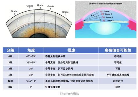 房角|包你会教程系列之「房角镜检查」